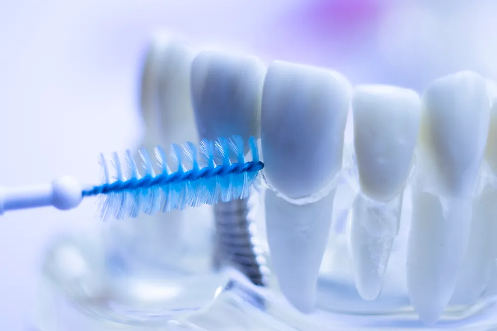 The Benefits of Interdental Brushes for Teeth