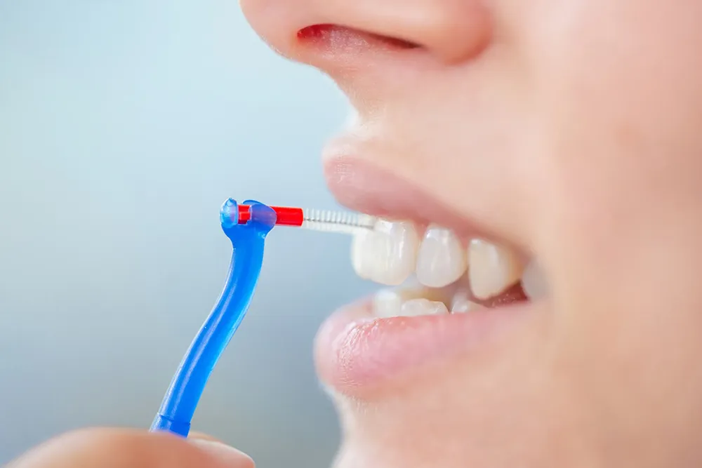 The Correct Way to Use an Interdental Brush